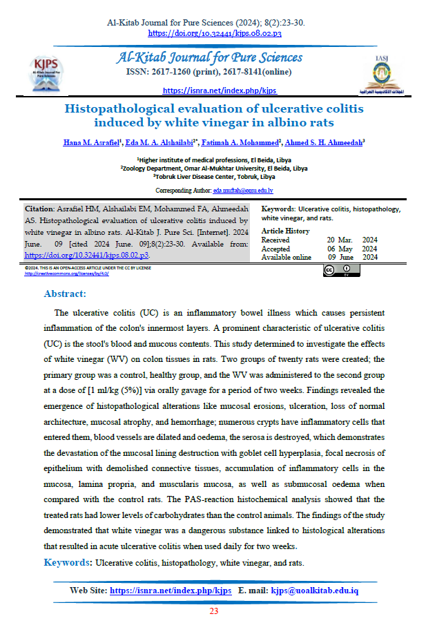Histopathological evaluation of ulcerative colitis induced by white vinegar in albino rats